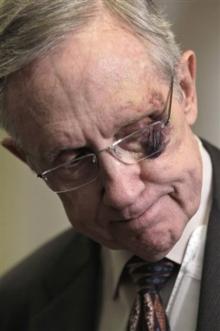 HARRY-REID-AP-BLACK-EYE.jpg